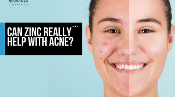 Can zinc really help with acne?