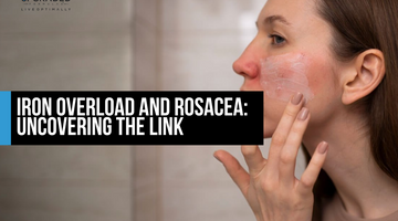 Iron Overload and Rosacea: Uncovering the Link